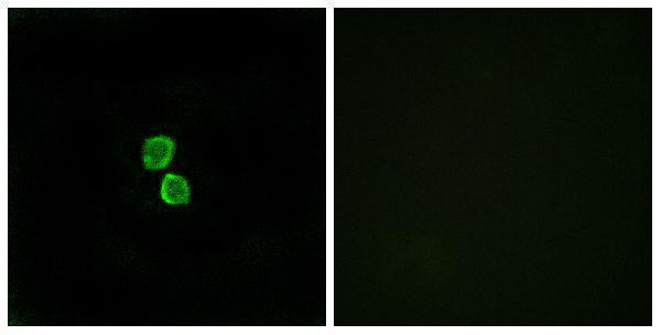 a30611 cmtm1 primary antibodies if testing 1