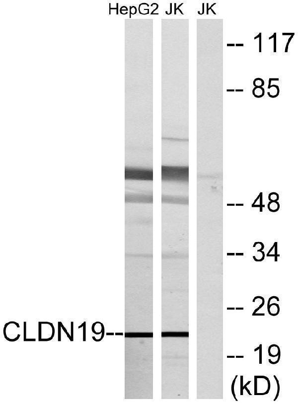 Western blot analysis of lysates from Jurkat and HepG2 cells, using CLDN19 Antibody