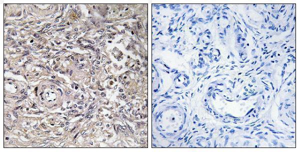 a30616 cldn6 primary antibodies ihc testing 2