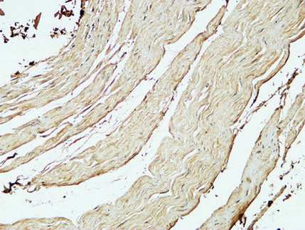 Immunohistochemical analysis of paraffin-embedded Human stomach