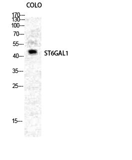 Western Blot analysis of COLO cells using CD75 Polyclonal Antibody diluted at 1:2000