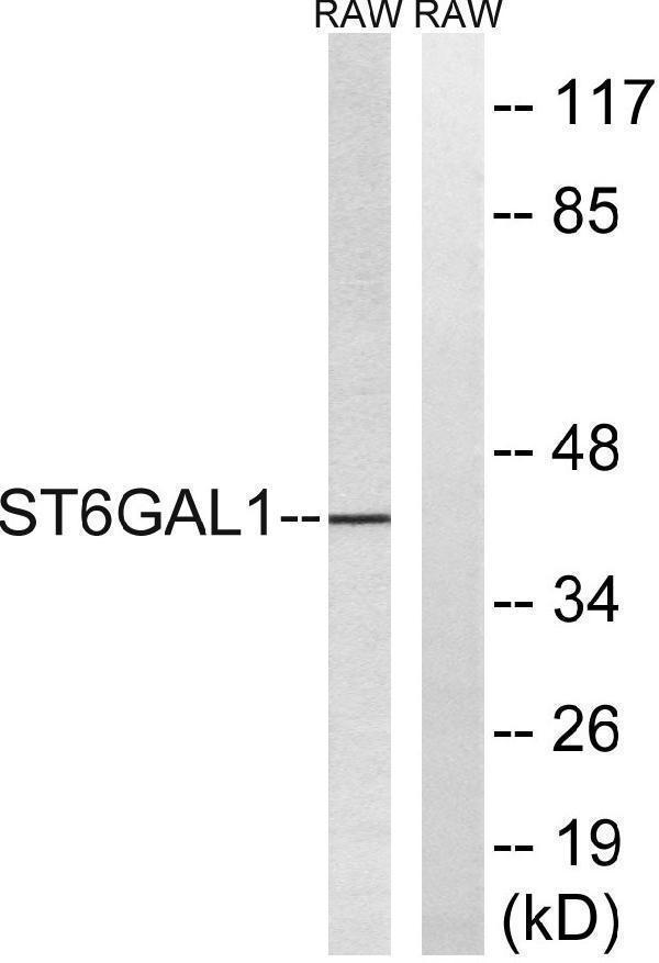 a30620 st6gal1 primary antibodies wb testing 4