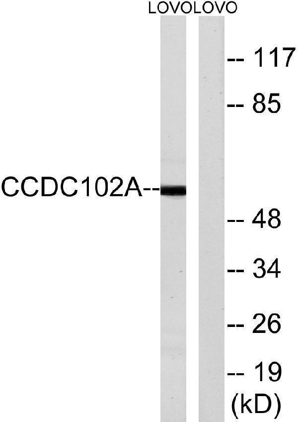 a30622 ccdc102a primary antibodies wb testing 1
