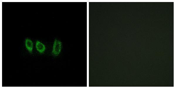 Immunofluorescence analysis of A549 cells, using CSTL1 Antibody