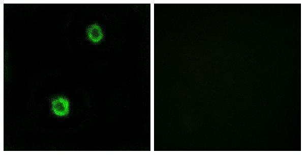 Immunofluorescence analysis of MCF7 cells, using CST1 Antibody