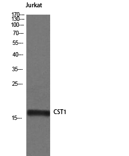Western Blot analysis of Jurkat cells using Cystatin SN Polyclonal Antibody