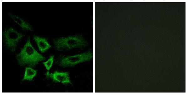 a30631 nt5c1a primary antibodies if testing 1