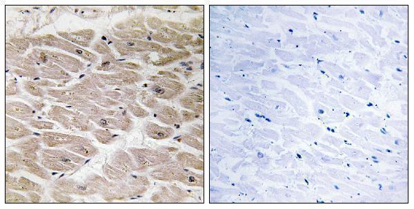 Immunohistochemistry analysis of paraffin-embedded human heart tissue, using CBCP2 Antibody