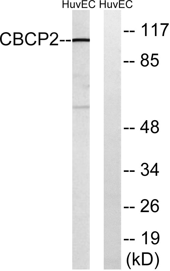 Western blot analysis of lysates from HUVEC cells, using CBCP2 Antibody