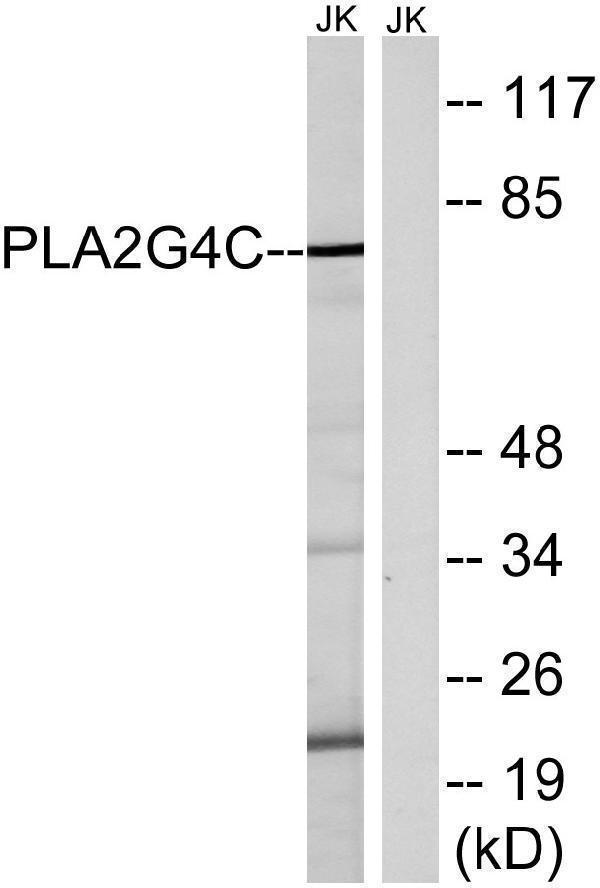 a30634 pla2g4c primary antibodies wb testing 1
