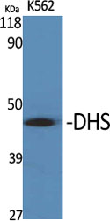 a30637 dhps primary antibodies wb testing 2