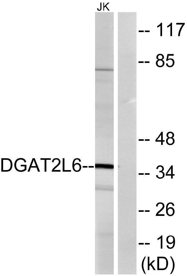 Western blot analysis of lysates from Jurkat cells, using DGAT2L6 Antibody