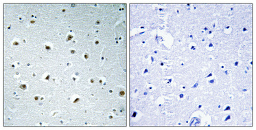 a30655 polr2e primary antibodies ihc testing 1