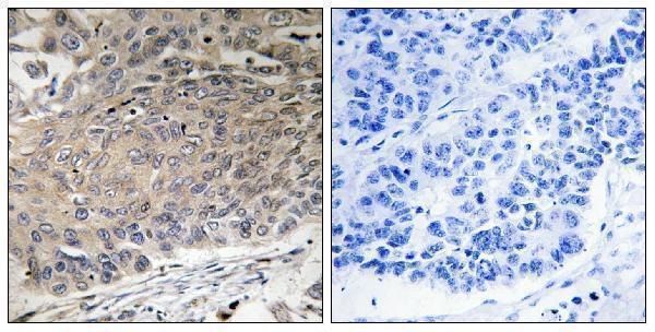a30657 dynll2 primary antibodies ihc testing 1
