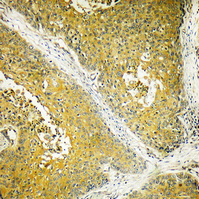 a30657 dynll2 primary antibodies ihc testing 2