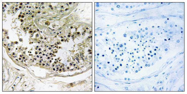 a30658 dynlrb2 primary antibodies ihc testing 1