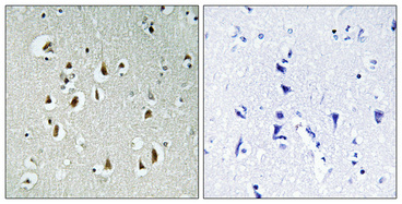 Immunohistochemical analysis of paraffin-embedded Human brain