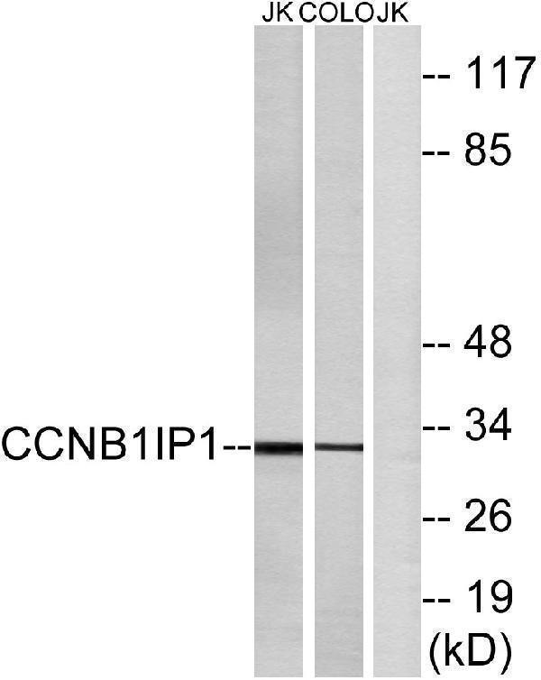 Western blot analysis of lysates from Jurkat and COLO cells, using CCNB1IP1 Antibody