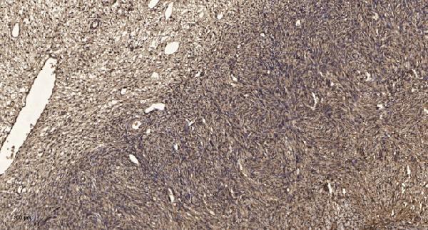 a30665 rnf138 primary antibodies ihc testing 1