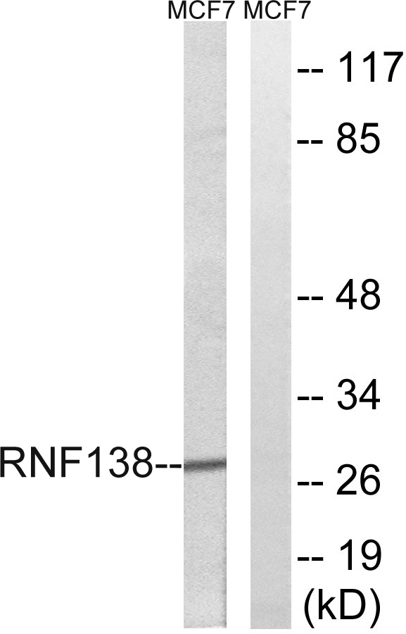 a30665 rnf138 primary antibodies wb testing 2