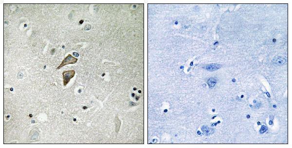 a30667 rnf149 primary antibodies ihc testing 1