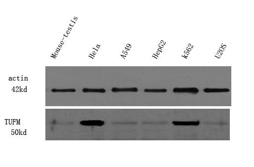 Western Blot analysis of various cell lysis