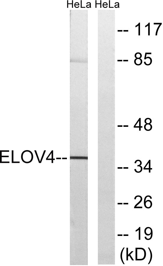 a30673 elovl4 primary antibodies wb testing 2