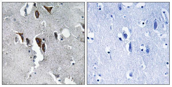 a30674 elovl5 primary antibodies ihc testing 1
