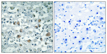 Immunohistochemical analysis of paraffin-embedded Human brain