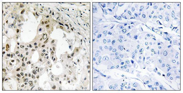 a30683 eif3d primary antibodies ihc testing 1