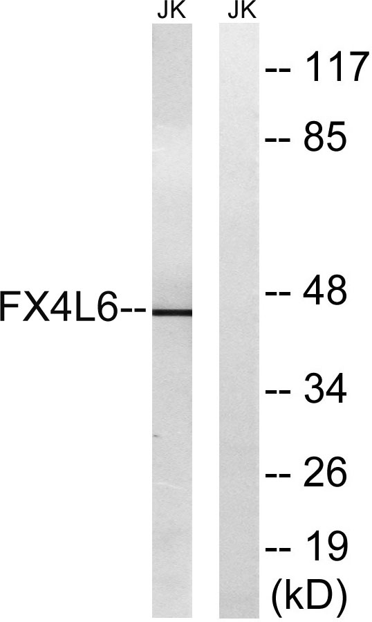 Western blot analysis of lysates from Jurkat cells, using FOXD4/L2/L3/L4/L5/L6 Antibody