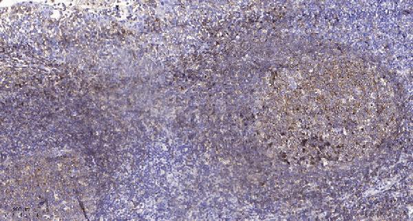 a30688 gabrd primary antibodies ihc testing 1
