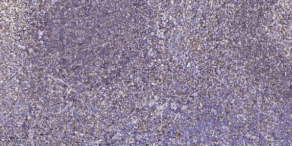 a30689 gabrg1 primary antibodies ihc testing 1