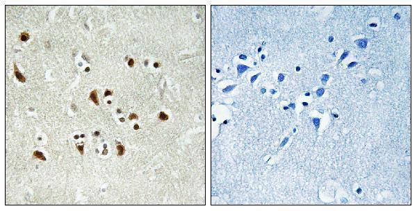 a30694 tubgcp6 primary antibodies ihc testing 1