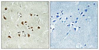 a30694 tubgcp6 primary antibodies ihc testing 2