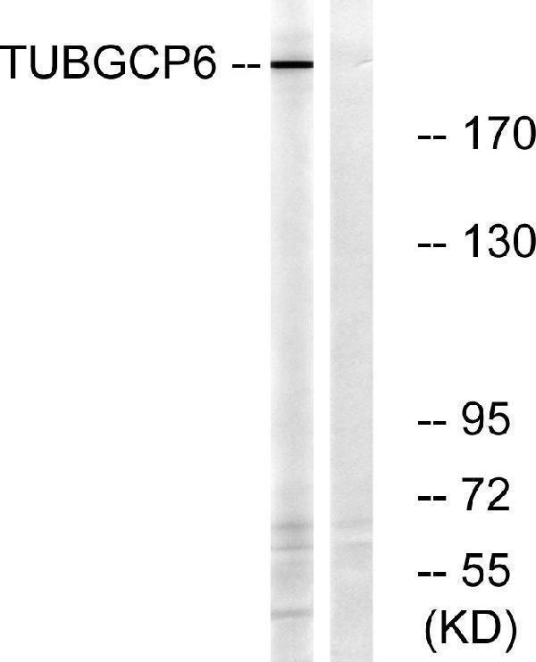 a30694 tubgcp6 primary antibodies wb testing 4