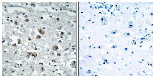 a30706 gprasp1 primary antibodies ihc testing 2