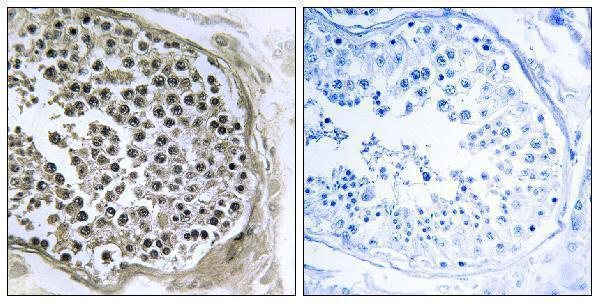 Immunohistochemistry analysis of paraffin-embedded human testis tissue, using GIDRP88 Antibody