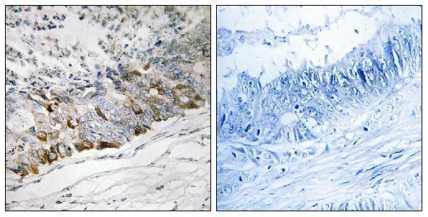 a30708 gchfr primary antibodies ihc testing 1