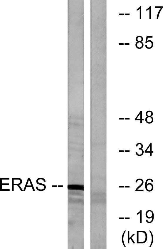 Western blot analysis of lysates from Jurkat cells, using ERAS Antibody