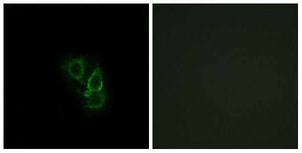Immunofluorescence analysis of A549 cells, using RAD Antibody
