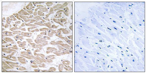 Immunohistochemistry analysis of paraffin-embedded human heart tissue, using RAD Antibody
