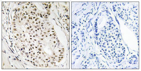 a30718 hnrnpul2 primary antibodies ihc testing 1