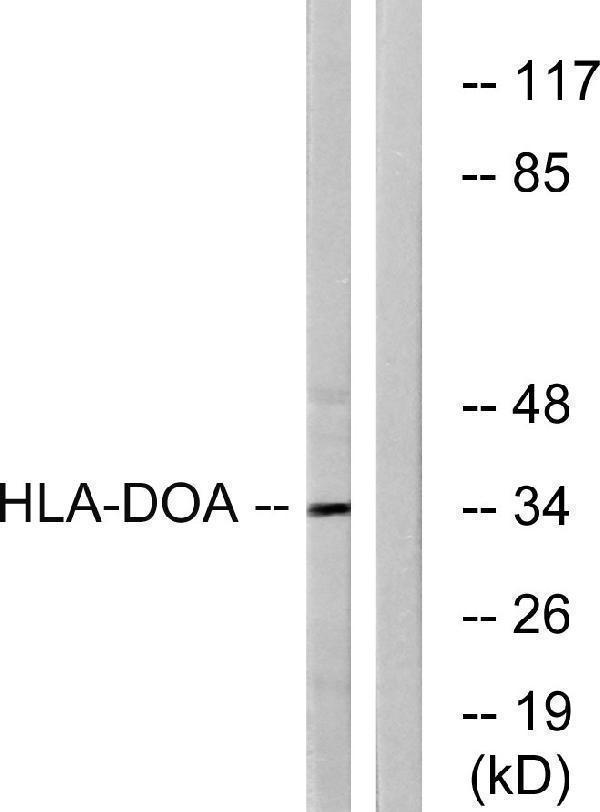 Western blot analysis of lysates from COLO cells, using HLA-DOA Antibody