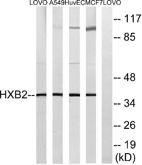 a30723 hoxb2 primary antibodies wb testing 1