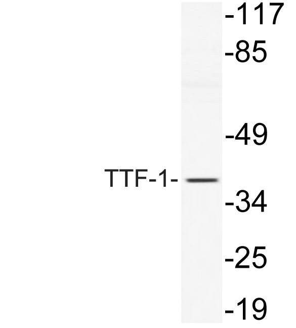 Western blot analysis of lysate from NIH/3T3 cells, using TTF-1 antibody