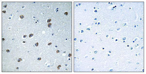 a30731 klhl29 primary antibodies ihc testing 1