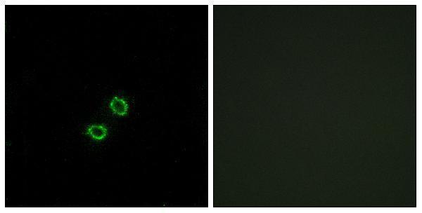 a30732 kir2dl5b primary antibodies if testing 1