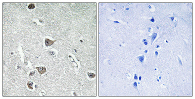 a30733 aasdhppt primary antibodies ihc testing 1