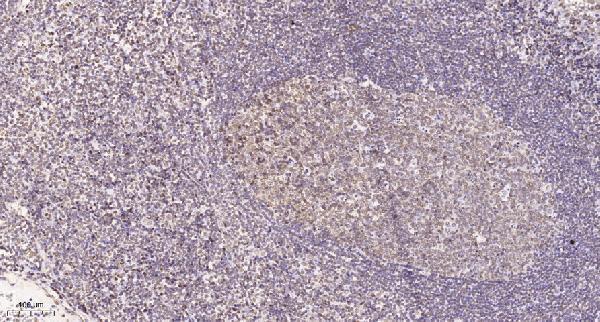 a30736 lrrc41 primary antibodies ihc testing 1